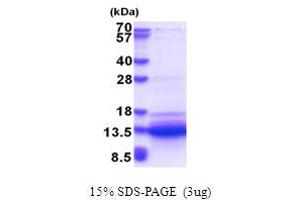 SDS-PAGE (SDS) image for Small VCP/p97-Interacting Protein (SVIP) (AA 1-77) protein (His tag) (ABIN5853642) (SVIP Protein (AA 1-77) (His tag))
