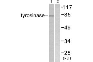 Western blot analysis of extracts from COS7 cells, treated with UV (30mins), using Tyrosinase antibody. (TYR Antikörper  (C-Term))