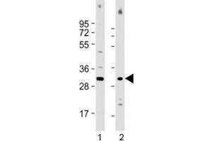 Western blot testing of human 1) Jurkat and 2) HL-60 cell lysate with COPS7B antibody at 1:1000. (COPS7B Antikörper  (AA 223-257))