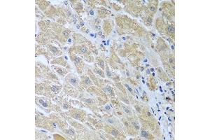 Immunohistochemistry of paraffin-embedded human liver using WDR48 antibody at dilution of 1:100 (40x lens). (WDR48 Antikörper)
