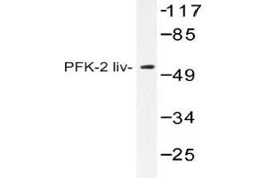 Western blot (WB) analysis of AP20411PU-N PFK-2 liv antibody in extracts from HUVEC cells. (PFKFB1 Antikörper)