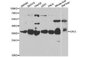 Western blot analysis of extracts of various cell lines, using GALE antibody. (GALE Antikörper  (AA 129-348))