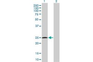 Western Blot analysis of RAB32 expression in transfected 293T cell line by RAB32 MaxPab polyclonal antibody. (RAB32 Antikörper  (AA 1-225))