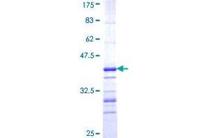 CBR3 Protein (AA 180-277) (GST tag)