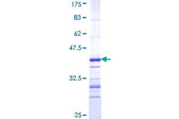 CBR3 Protein (AA 180-277) (GST tag)