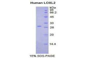 SDS-PAGE (SDS) image for Lysyl Oxidase-Like 2 (LOXL2) (AA 544-751) protein (His tag) (ABIN1878325)