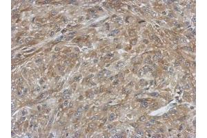 IHC-P Image Immunohistochemical analysis of paraffin-embedded U87 xenograft, using Ferredoxin Reductase, antibody at 1:500 dilution. (Ferredoxin Reductase Antikörper)