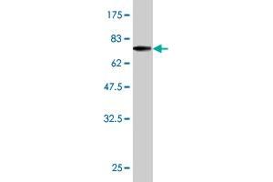 Western Blot detection against Immunogen (70. (ERCC2 Antikörper  (AA 1-405))