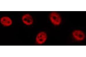 ABIN6277119 staining  HeLa cells by IF/ICC. (p63 Antikörper)
