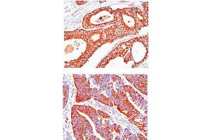 Immunohistochemistry (IHC) image for anti-Heat Shock 60kDa Protein 1 (Chaperonin) (HSPD1) (AA 1-573), (N-Term) antibody (ABIN263917) (HSPD1 Antikörper  (N-Term))