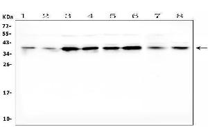 Western blot analysis of DKK1 using anti-DKK1 antibody (ABIN3043203).