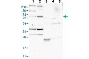 Western blot analysis of Lane 1: RT-4, Lane 2: U-251 MG, Lane 3: Human Plasma, Lane 4: Liver, Lane 5: Tonsil with LOC389813 polyclonal antibody  at 1:250-1:500 dilution.