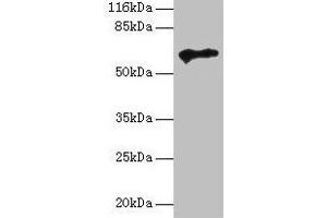 Western blot All lanes: TPTE antibody at 2 μg/mL + HepG2 whole cell lysate Secondary Goat polyclonal to rabbit IgG at 1/10000 dilution Predicted band size: 65, 63, 61, 50 kDa Observed band size: 65 kDa (TPTE Antikörper  (AA 175-380))