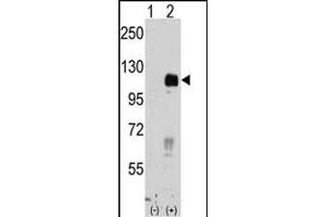 Western blot analysis of EphB4 (arrow) using rabbit polyclonal EphB4 Antibody (ABIN391924 and ABIN2841734). (EPH Receptor B4 Antikörper)