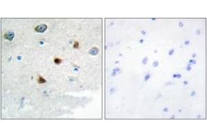 Immunohistochemistry analysis of paraffin-embedded human brain tissue, using DUSP4 Antibody.