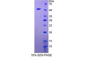 Image no. 1 for Adhesion Regulating Molecule 1 (Adrm1) (AA 2-407) protein (His tag) (ABIN6238006)