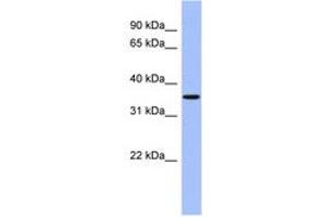 Image no. 1 for anti-Protein Phosphatase, Mg2+/Mn2+ Dependent, 1A (PPM1A) (AA 107-156) antibody (ABIN6744214) (PPM1A Antikörper  (AA 107-156))