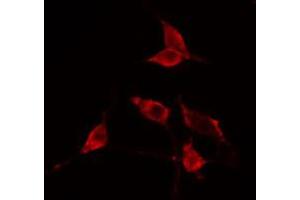 ABIN6274753 staining Hela cells by IF/ICC. (RPS23 Antikörper  (N-Term))