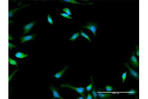 Immunofluorescence of purified MaxPab antibody to PFKFB1 on HeLa cell. (PFKFB1 Antikörper  (AA 1-471))