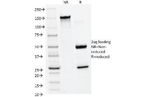 SDS-PAGE Analysis Purified MMP2 Monoclonal Antibody (MMP2/1501). (MMP2 Antikörper  (AA 444-575))