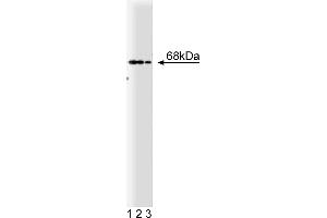 Western Blotting (WB) image for anti-Protein-tyrosine Phosphatase 1C (PTPN6) (AA 492-597) antibody (ABIN967767)