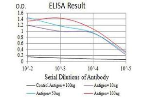 Black line: Control Antigen (100 ng),Purple line: Antigen (10 ng), Blue line: Antigen (50 ng), Red line:Antigen (100 ng) (BCMA Antikörper)