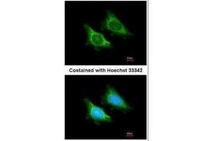 ICC/IF Image Immunofluorescence analysis of methanol-fixed HeLa, using MRPS5, antibody at 1:200 dilution. (MRPS5 Antikörper)