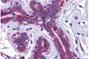 Human Breast: Formalin-Fixed, Paraffin-Embedded (FFPE) (SLC39A7 Antikörper  (N-Term))