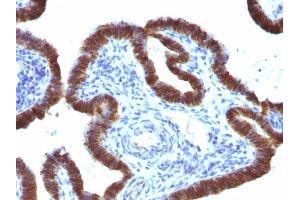 Formalin-fixed, paraffin-embedded human Fallopian Tube stained with ASRGL1 Mouse Monoclonal Antibody (CRASH/1289). (ASRGL1 Antikörper)