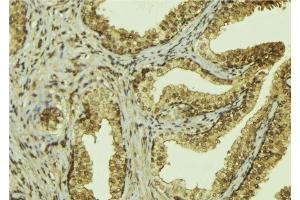 ABIN6276526 at 1/100 staining Mouse colon tissue by IHC-P. (MSH2 Antikörper  (C-Term))