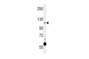 CACNA2D4 Antibody (N-term) (ABIN651895 and ABIN2840441) western blot analysis in K562 cell line lysates (15 μg/lane). (CACNA2D4 Antikörper  (N-Term))