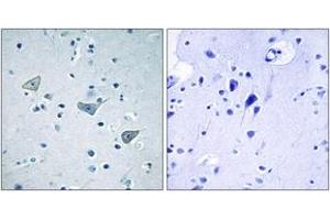 Immunohistochemistry analysis of paraffin-embedded human brain tissue, using GPR158 Antibody. (GPR158 Antikörper  (AA 1-50))