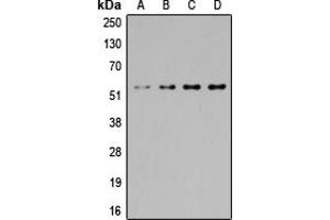 Western blot analysis of SGK1/2 expression in Jurkat (A), HeLa (B), NIH3T3 (C), PC12 (D) whole cell lysates. (SGK1/2 (Center) Antikörper)