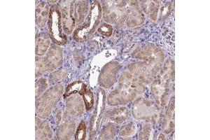 Immunohistochemical staining of human kidney with COX20 polyclonal antibody  shows strong cytoplasmic positivity in subset of renal tubules at 1:50-1:200 dilution. (FAM36A Antikörper)