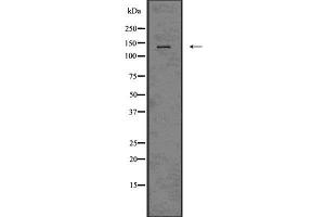 Western blot analysis CD11c using HeLa whole cell lysates (CD11c Antikörper  (N-Term))