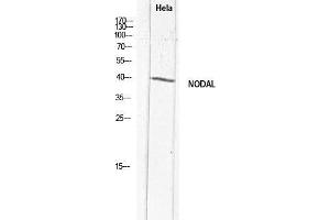 Western Blot (WB) analysis of HeLa lysis using NODAL antibody. (Nodal Antikörper)