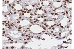ABIN6268824 at 1/100 staining human kidney tissue sections by IHC-P.