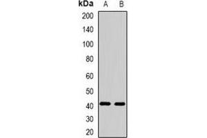 Western blot analysis of FBXO32 expression in mouse heart (A), mouse skeletal muscle (B) whole cell lysates. (FBXO32 Antikörper)