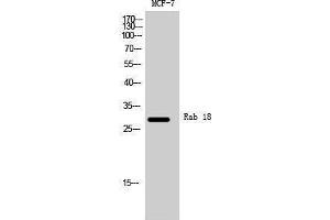 Western Blotting (WB) image for anti-RAB18, Member RAS Oncogene Family (RAB18) (Internal Region) antibody (ABIN3186613) (RAB18 Antikörper  (Internal Region))