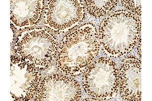 ABIN7095890 and ABIN7099952 at 1/100 staining rat testis tissue by IHC-P. (GRHL2 Antikörper)