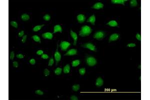 Immunofluorescence of monoclonal antibody to TFAP4 on HeLa cell. (TFAP4 Antikörper  (AA 93-192))