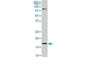 Western Blotting (WB) image for anti-Cofilin 1 (CFL1) (AA 1-167) antibody (ABIN598606) (Cofilin Antikörper  (AA 1-167))