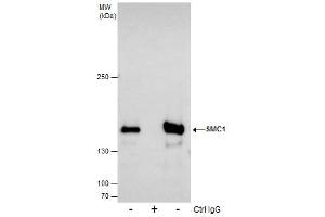 IP Image Immunoprecipitation of SMC1A protein from 293T whole cell extracts using 5 μg of SMC1A antibody [N1N2], N-term, Western blot analysis was performed using SMC1A antibody [N1N2], N-term, EasyBlot anti-Rabbit IgG  was used as a secondary reagent. (SMC1A Antikörper  (N-Term))