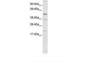 Image no. 1 for anti-TEA Domain Family Member 1 (SV40 Transcriptional Enhancer Factor) (TEAD1) (N-Term) antibody (ABIN202462) (TEAD1 Antikörper  (N-Term))