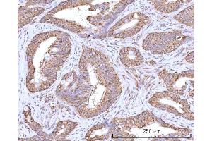 IHC analysis of RPN1 using anti-RPN1 antibody (ABIN7600447).