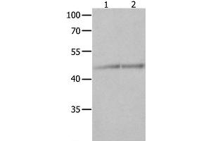 Western Blot analysis of Jurkat and K562 cell using NCK1 Polyclonal Antibody at dilution of 1:600 (NCK1 Antikörper)