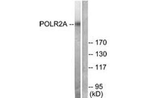 Western blot analysis of extracts from COS7 cells, treated with EGF 200ng/ml 30', using POLR2A (Ab-1619) Antibody. (POLR2A/RPB1 Antikörper  (AA 1585-1634))