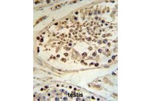 Immunohistochemistry (Paraffin-embedded Sections) (IHC (p)) image for anti-DEK Oncogene (DEK) (AA 343-372), (C-Term) antibody (ABIN951879)