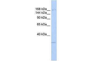 Western Blotting (WB) image for anti-Lysine (K)-Specific Demethylase 6A (KDM6A) antibody (ABIN2458408) (KDM6A Antikörper)