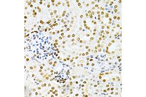Immunohistochemistry of paraffin-embedded mouse kidney using DKC1 Antibody (ABIN3022640, ABIN3022641, ABIN1512829 and ABIN6218993) at dilution of 1:200 (40x lens).